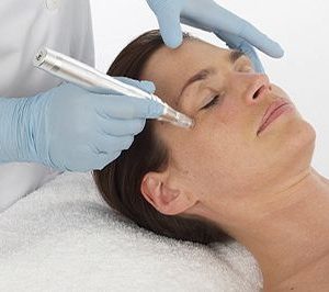 Level 4 Award in Skin Needling